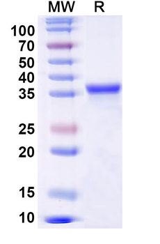Recombinant Mouse RIPK1 Protein, N-His