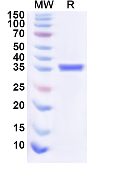 Recombinant Human PDPN/Podoplanin Protein, N-His-KSI