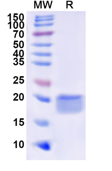 Recombinant Human DEFB1 Protein, N-His-KSI