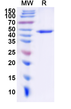 Recombinant Human CHRM3 Protein, N-His-KSI