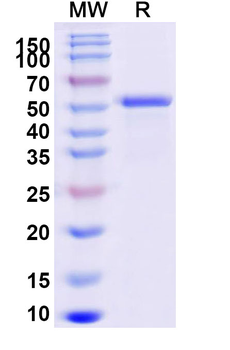 Recombinant Human GLCE Protein, N-His