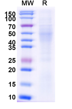 Recombinant Mouse VTCN1/B7-H4 Protein, C-His