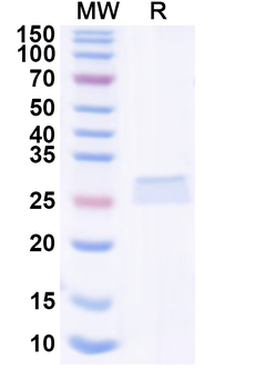 Recombinant Human ITPRIPL1 Protein, N-His-KSI