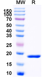 Recombinant Mouse CD339/JAG1 Protein, N-His