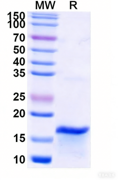 Recombinant PRRSV Nucleoprotein Protein, N-His
