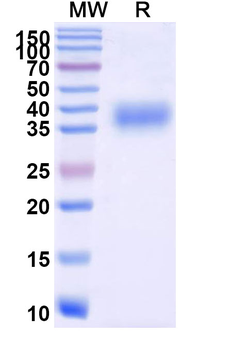 Recombinant SARS-CoV-2 Spike (RBD) Protein (BA.2.86), C-His