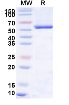 Recombinant Human Monoamine Oxidase B/MAOB/AOFB protein, N-His