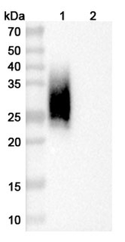 Recombinant Mouse CD47/IAP Protein, C-His