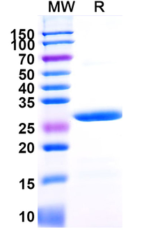 Recombinant Mouse β-tryptase/TPSAB1 Protein, N-His