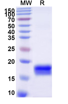 Recombinant Human TGFBR2/TGFR-2 Protein, N-His