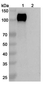 Recombinant Human CD22 Protein, C-His