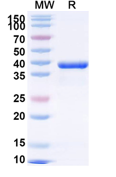 Recombinant Cat Fel d 1A/CH1 Protein, N-GST & C-His