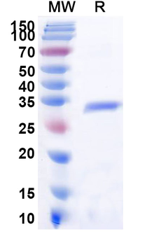Recombinant Human/Mouse/Rat KAT7 Protein, N-His