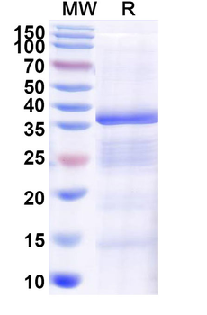 Recombinant Human SLC34A2/NaPi2b Protein, N-GST