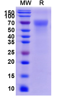 Recombinant Human CD113/NECTIN3 Protein, C-His