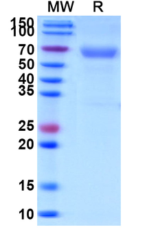 Recombinant Human CD320 Protein, C-Fc