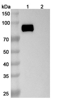 Recombinant Human CD213a2/IL13RA2 Protein, C-Fc