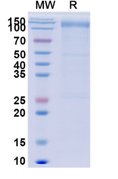 Recombinant Human CD118/LIFR Protein, C-His