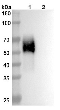 Recombinant Human CD334/FGFR4 Protein, C-His
