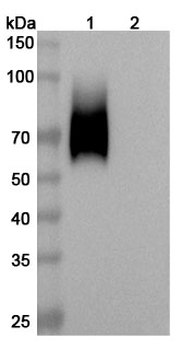 Recombinant Human CD66a/CEACAM1 Protein, C-His