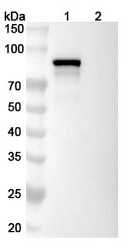 Recombinant Human CD71/TFRC Protein, C-His