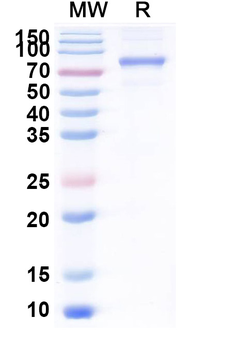 Recombinant Human CD71/TFRC Protein, C-His