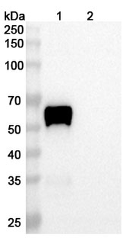 Recombinant Human FZD7 Protein, C-Fc