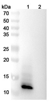 Recombinant Monkeypox virus/MPXV A29L Protein, C-His