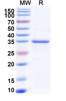 Recombinant Monkeypox virus/MPXV A27L Protein, N-His