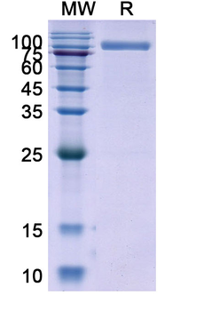 Recombinant Human CD26/DPP4 Protein, C-His