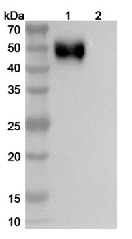 Recombinant Human CD172a/SIRPA Protein, C-His