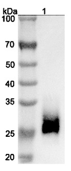 Recombinant Human CD147/BSG Protein, C-His
