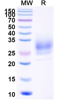 Recombinant Human CD147/BSG Protein, C-His