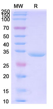Recombinant Human CBR1 Protein, N-His