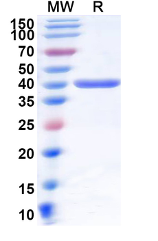 Recombinant Human CD218b/IL18RAP Protein, N-His