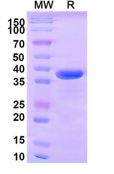 Recombinant Human CD148/PTPRJ Protein, N-His
