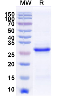 Recombinant Human EEF1A1 Protein, N-His