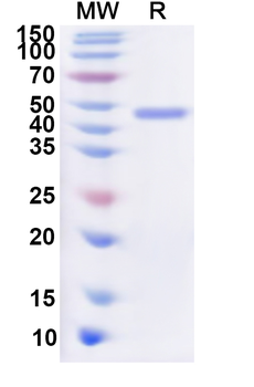 Recombinant Human METAP2 Protein, N-His
