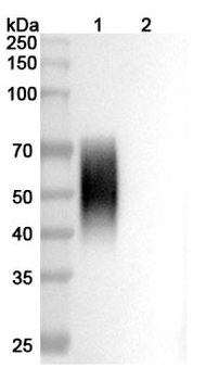 Recombinant Human CD86/B7-2 Protein, C-His