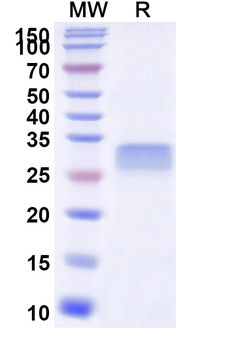 Recombinant Human CD26/DPP4 Protein, N-His