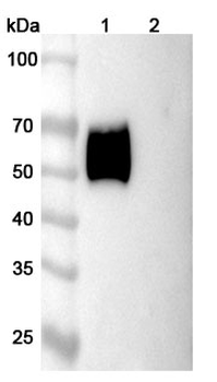 Recombinant Human CD116/CSF2RA Protein, C-His