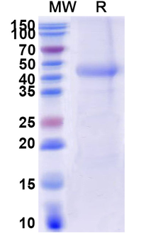 Recombinant Human CD116/CSF2RA Protein, C-His