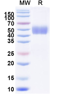 Recombinant Human CD331/FGFR1 Protein, C-His