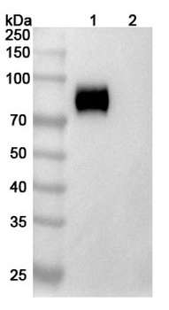 Recombinant Human CD115/CSF1R Protein, C-His