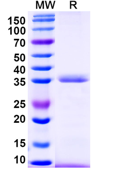 Recombinant Human SERPINA7 Protein, N-His