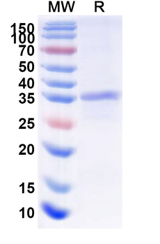 Recombinant Human KLKB1 Protein, N-His