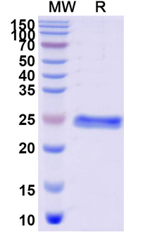 Recombinant Human Alpha-1-microglobulin/α1-MG Protein, N-His