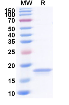 Recombinant Human TNFa/TNF-alpha Protein, N-His