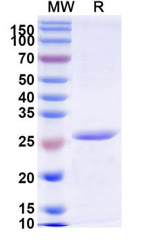 Recombinant Human CFB Protein, N-His