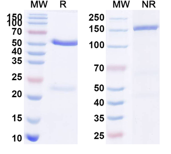 CD56/NCAM1 Rabbit Monoclonal Antibody